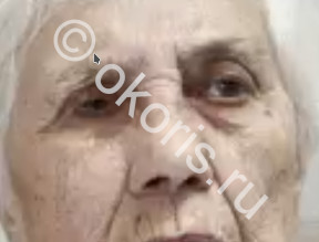 Угадай какой глаз искусственный Угадай какой глаз искусственный