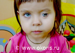 В 2 года дочка сама научилась вынимать протез В 2 года дочка сама научилась вынимать протез