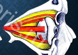Помощь при врожденных пороках глаза - микрофтальм и анофтальм Помощь при врожденных пороках глаза - микрофтальм и анофтальм
