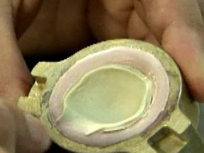 Глазной протез из силикона: склера без радужки Глазной протез из силикона: склера без радужки