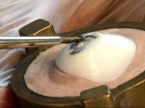 Глазной протез из силикона: радужка и сосуды Глазной протез из силикона: радужка и сосуды