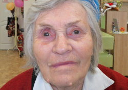 Протезирование глаза важно в любом возрасте Протезирование глаза важно в любом возрасте