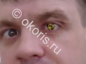 Преодоление. История 3: Дмитрий Преодоление. История 3: Дмитрий