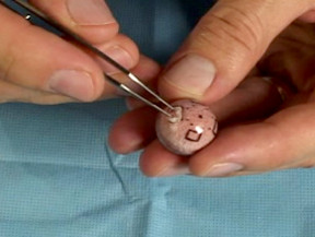 Bio глаз с имплантатом V-2 Bio глаз с имплантатом V-2